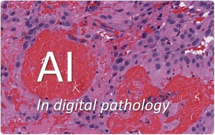 histopathology-ai